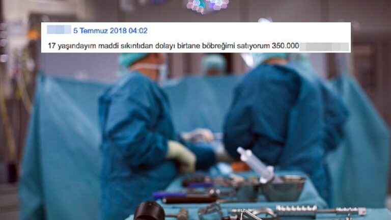 turkiyede satilik bobrek ilani artiyor